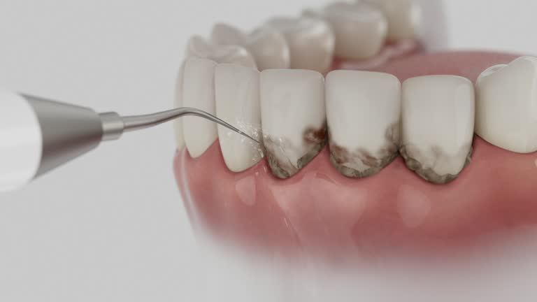 Reliable Dental contractor in Ridgemark, CA by Smile Center Dentistry